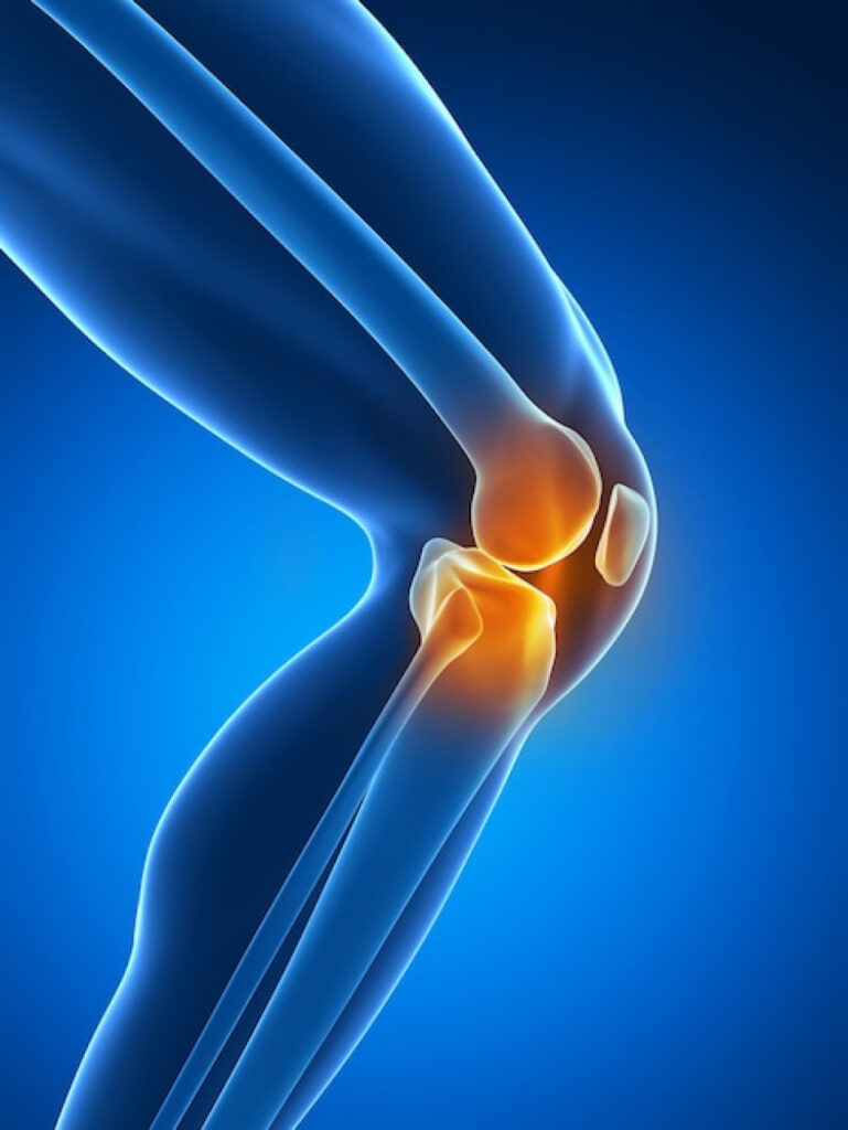 joint-pain-01